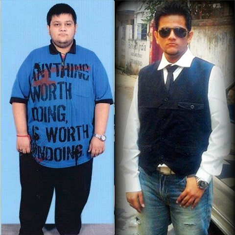 obesity patient after bariatrtic surgery