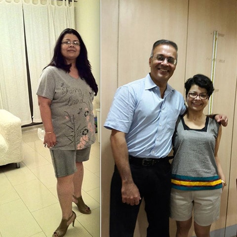 women looses her weight after bariatric surgery by doctor ramana